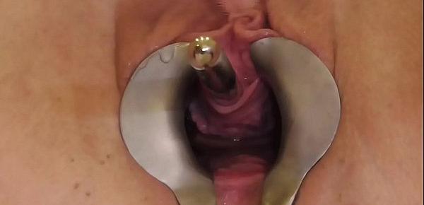  Analslut - James playing with her urethra - pee, sounds, stretching - Gaping pussy